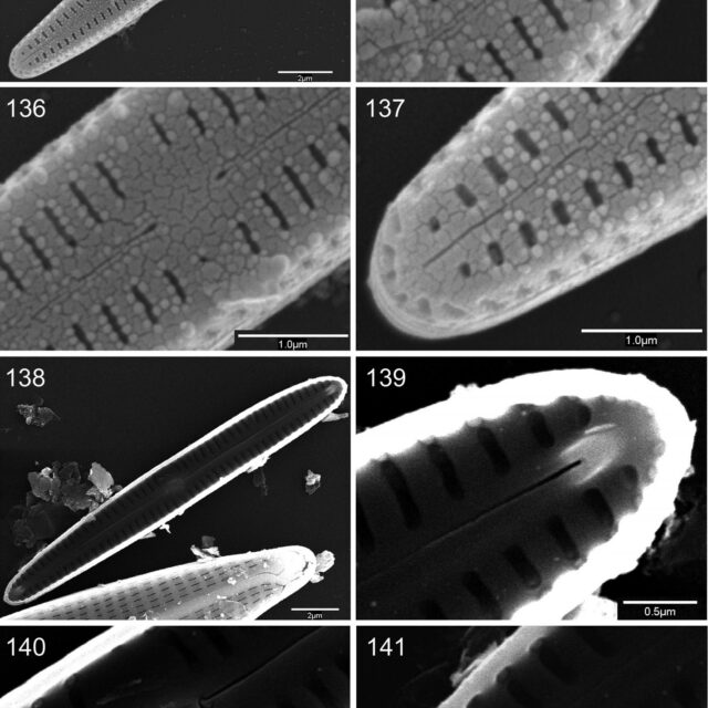 Gomphosphenia Stoermeri orig illus SEM