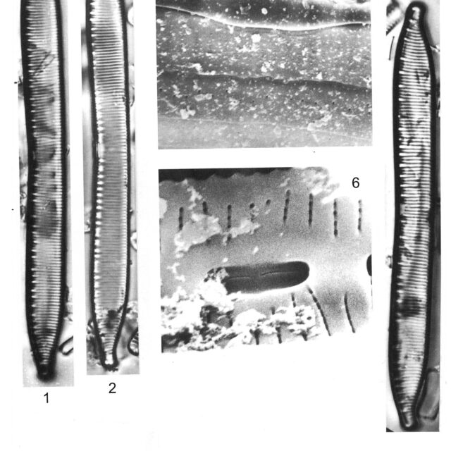 Hantzschia calc