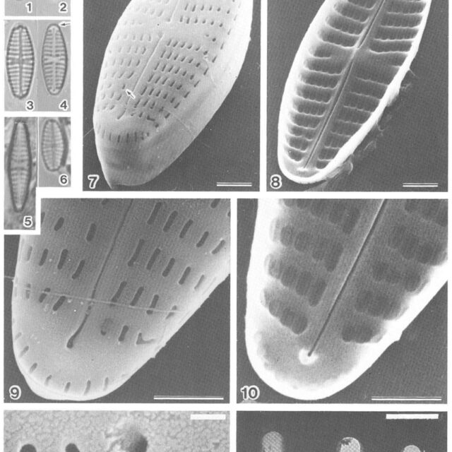 Hip Pseudacceptata Orig Desc Plate