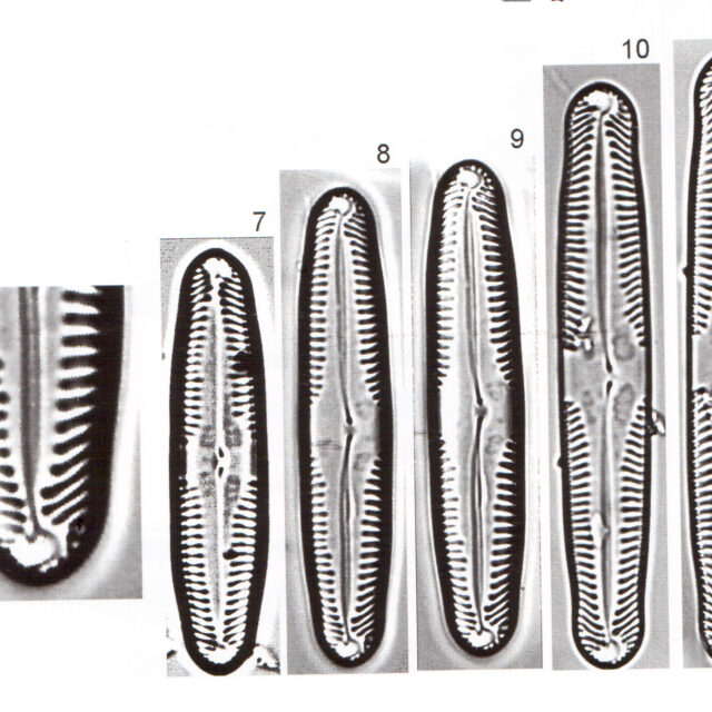 Pinnularia Parvulissima Scan 1