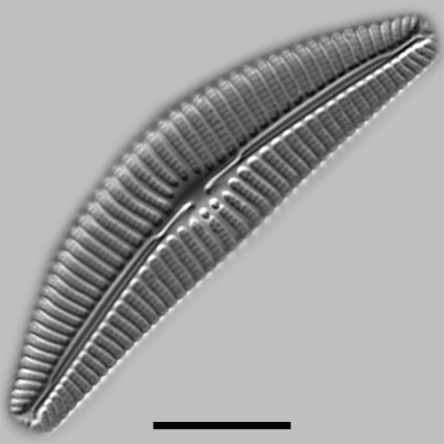 Cymbella Subturdigula Iconic