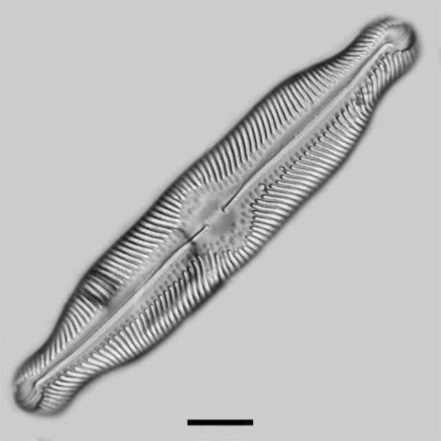 Pinnularia undula iconic