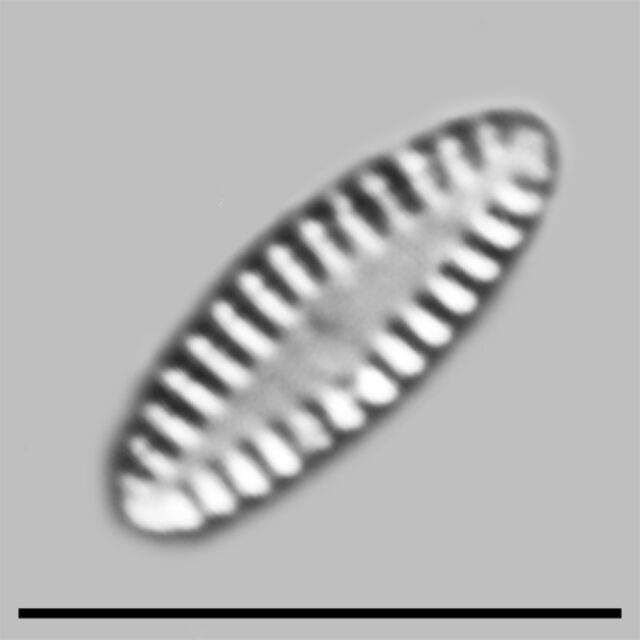 Pseudostaurosira Elliptica Iconic