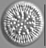 Cyclotella Radiosa 8