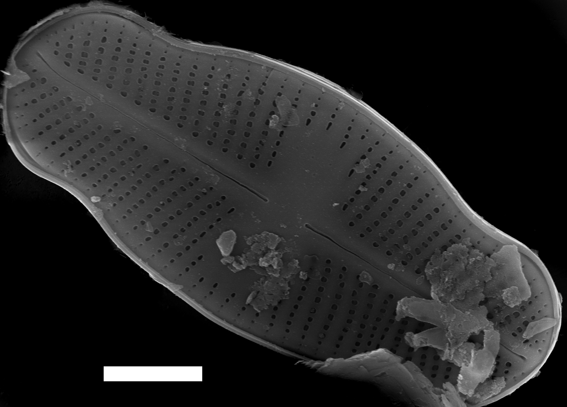 Psammothidium Ventrale gs007701 03 SEM