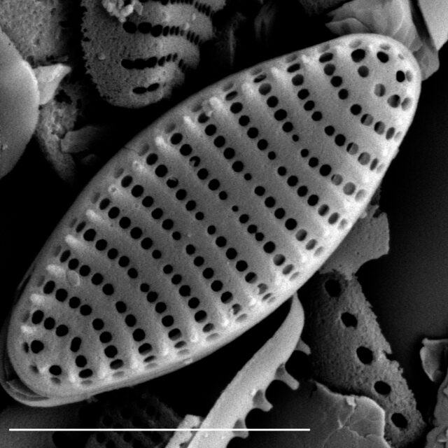  Stauroforma exiguiformis SEM1