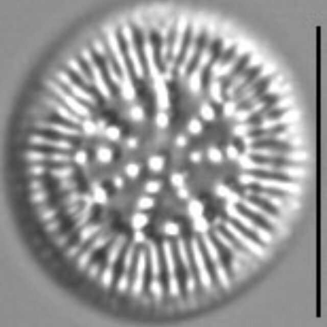 Cyclotella Radiosa 8