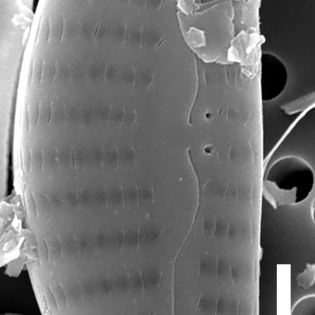 Cymbellacosleyi  Sem External Scale5Mu