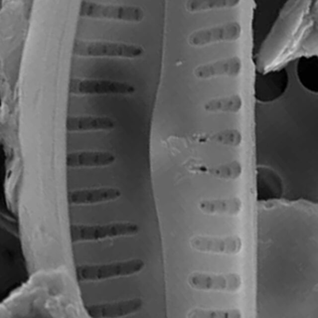 Cymbellacosleyi  Sem Internal Scale5Mu