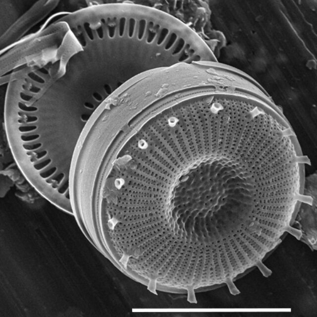 Discostella asterocostata SEM9