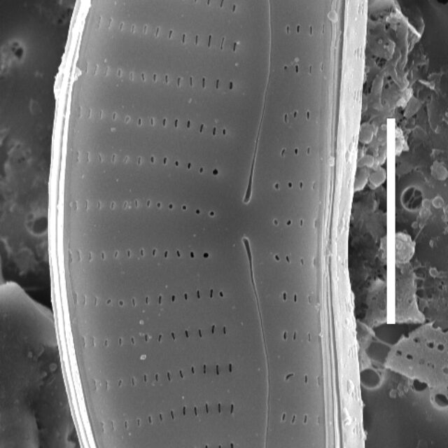 Encyonema procerum  Sem Wholevalve External