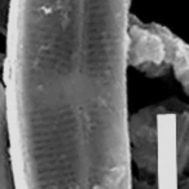 Nupelatenuicephala  Sem Externalwholevalve 494201 5Microns