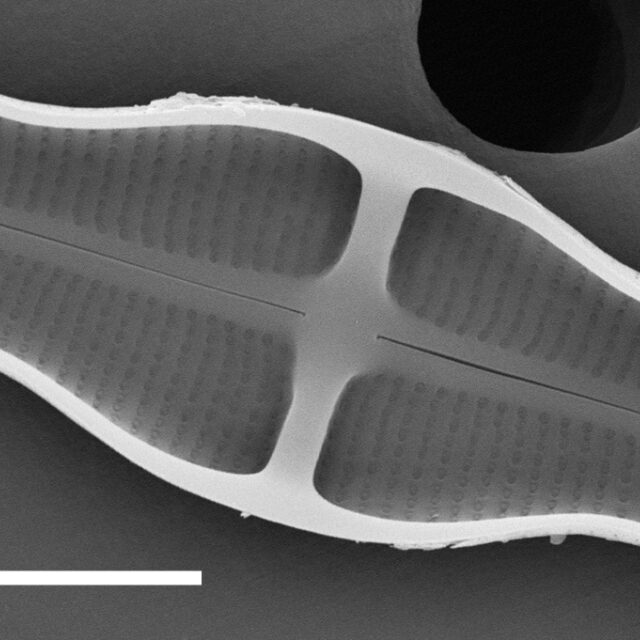 Stauroneis Smithii SEM1