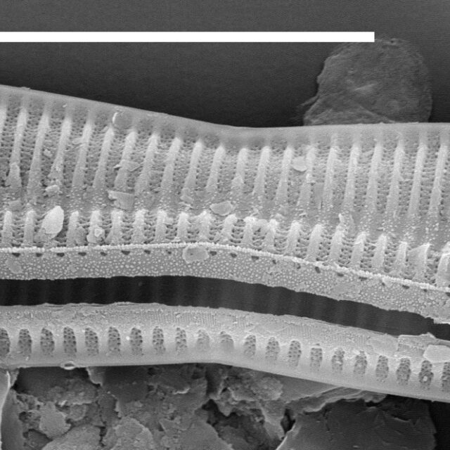 Tryblionella Apiculata 15631  Sem 100