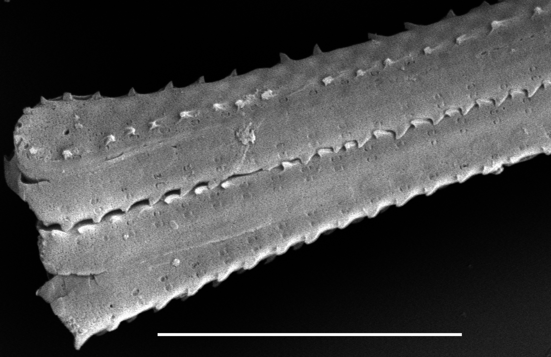 Fragilaria crotonensis SEM2
