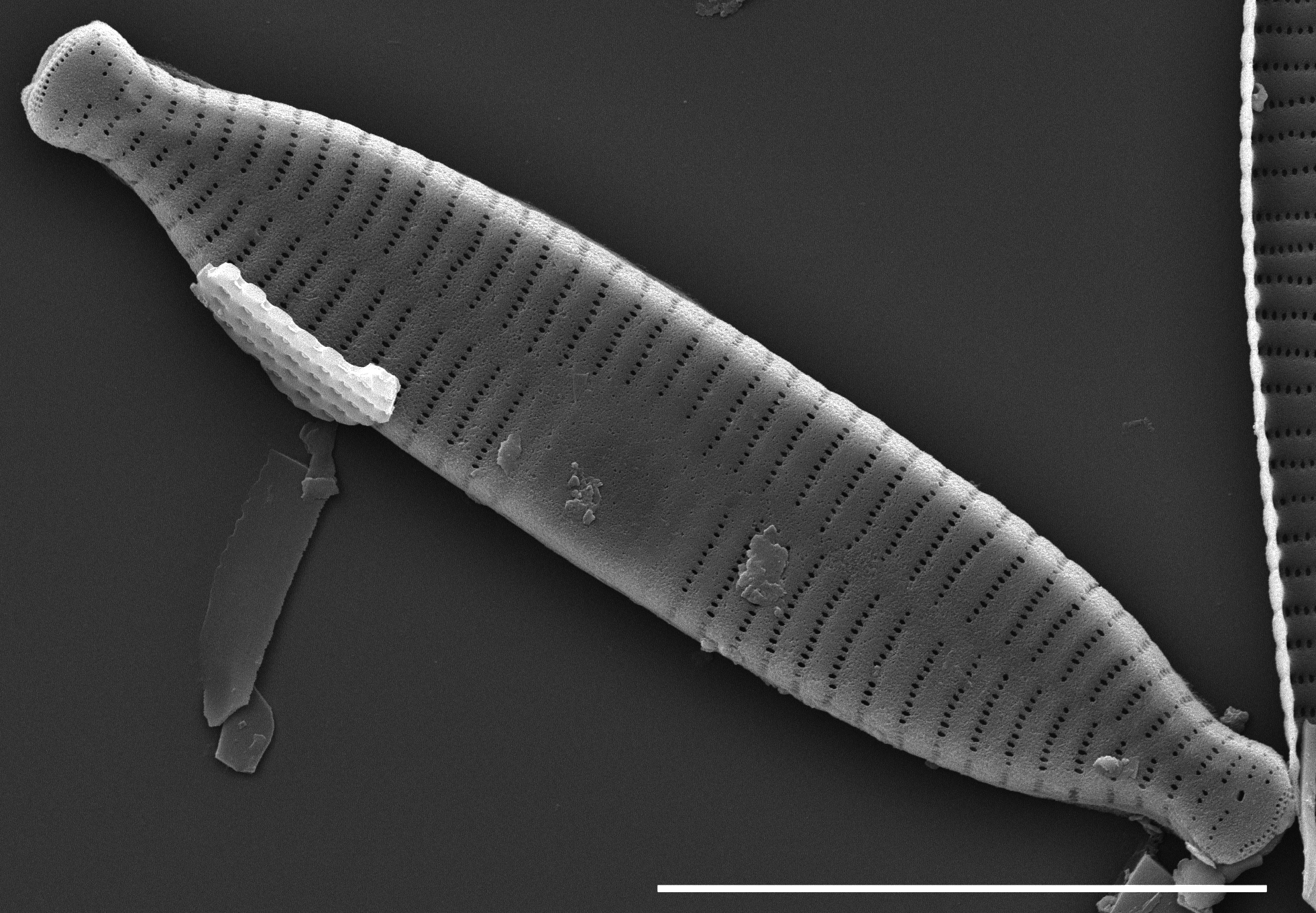 Fragilaria recapitellata SEM1