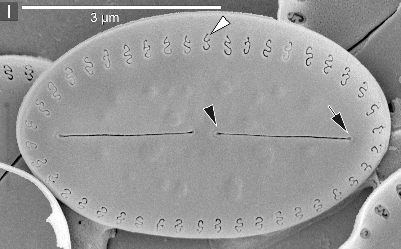 Amicula vermiculata SEM1