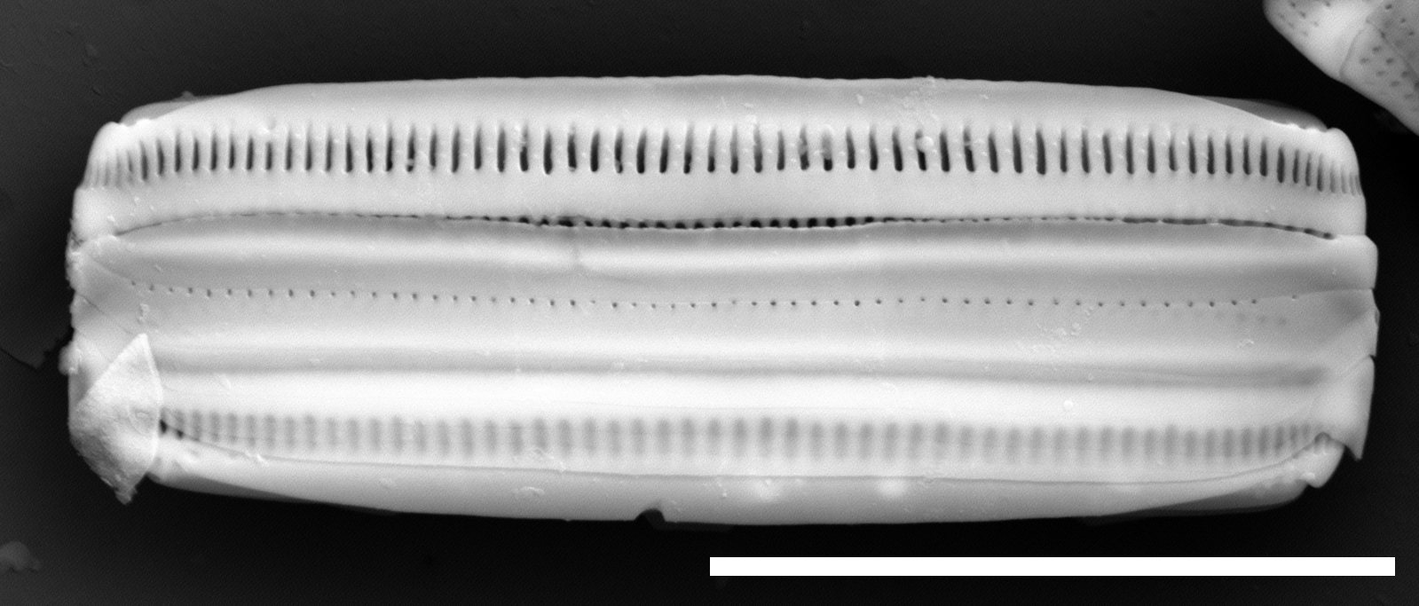 Brachysira confusa SEM3