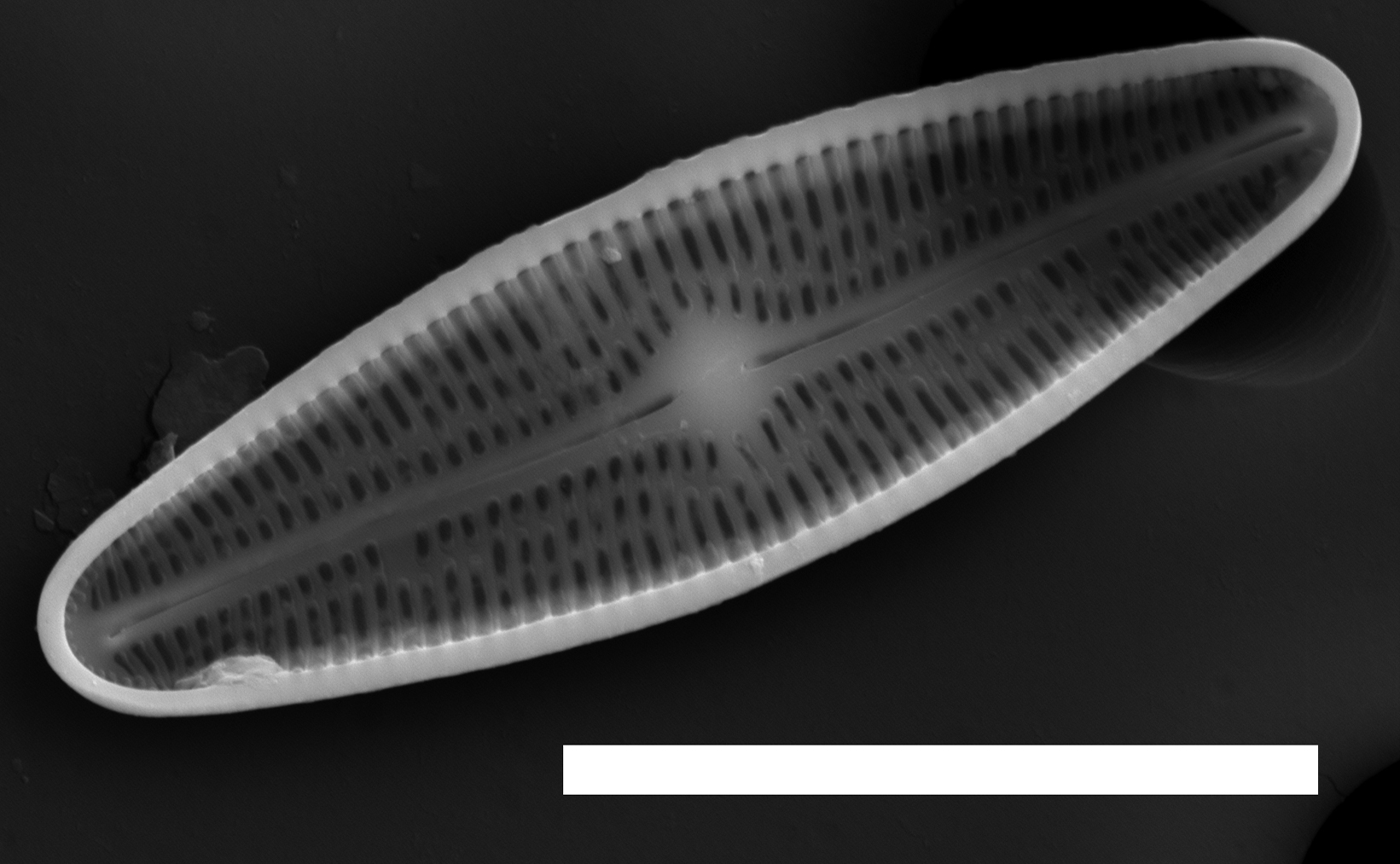 Brachysira confusa SEM5