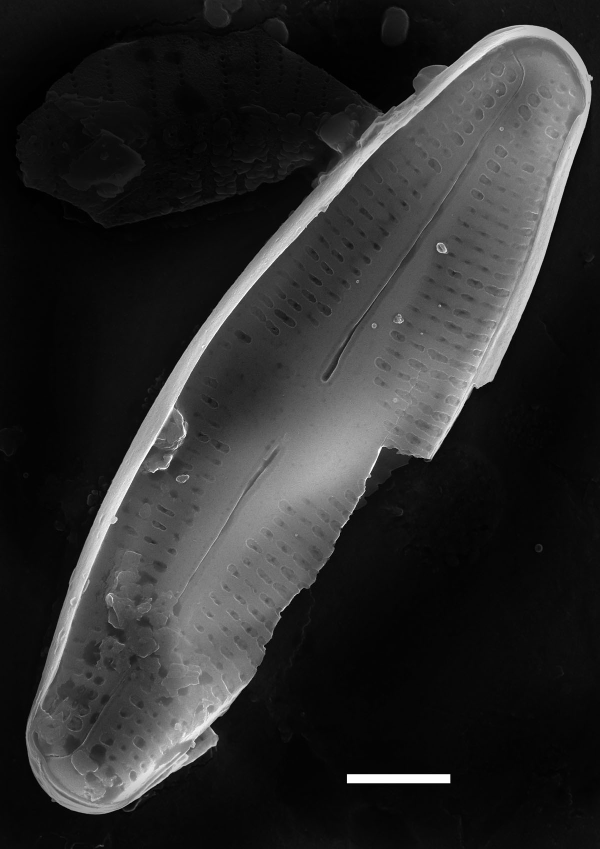 Nupela poconoensis SEM1