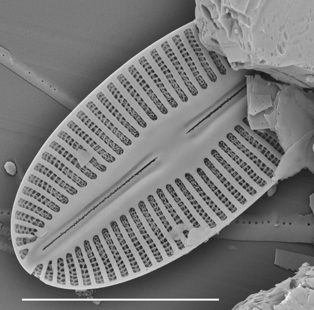 Image CT_06_mix_040.jpg | Species - Diatoms of North America