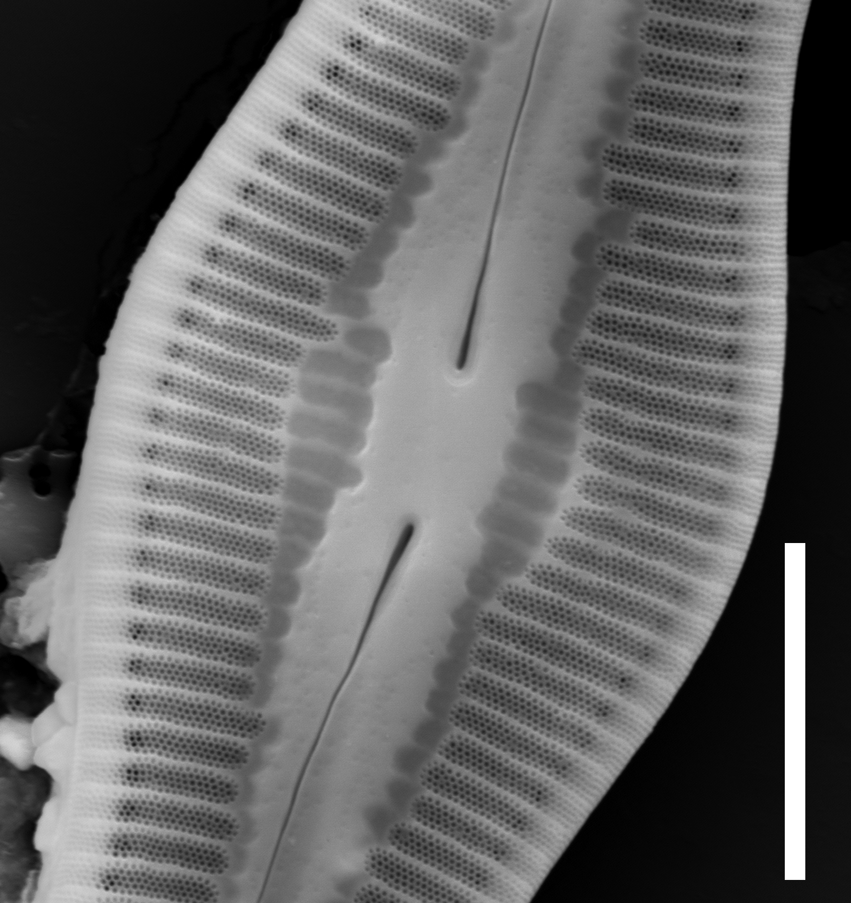 Caloneis c f ventricosa external view central area 5µm