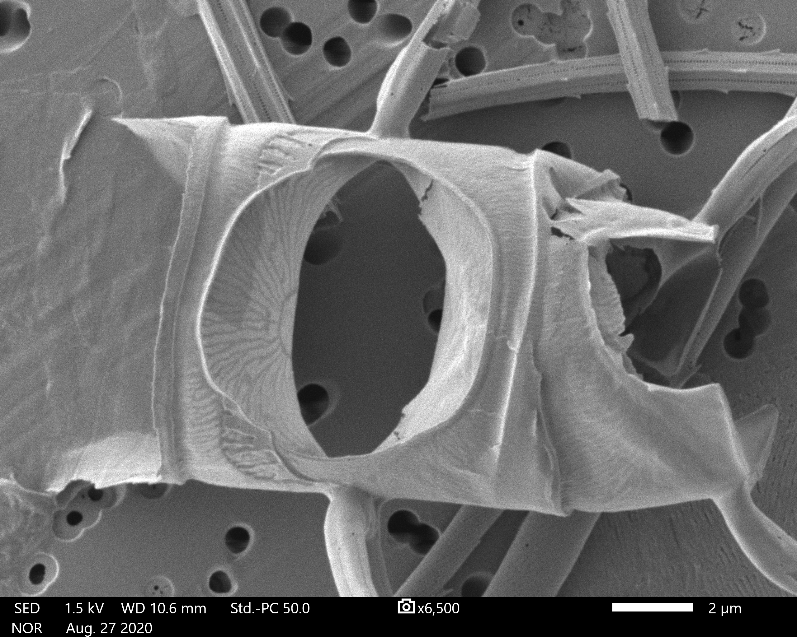 Chaetoceros constrictus SEM1