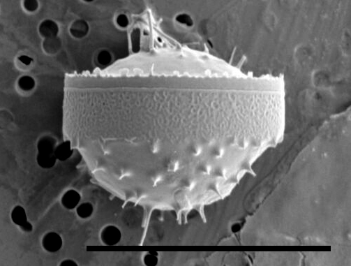 Chaetoceros constrictus SEM5