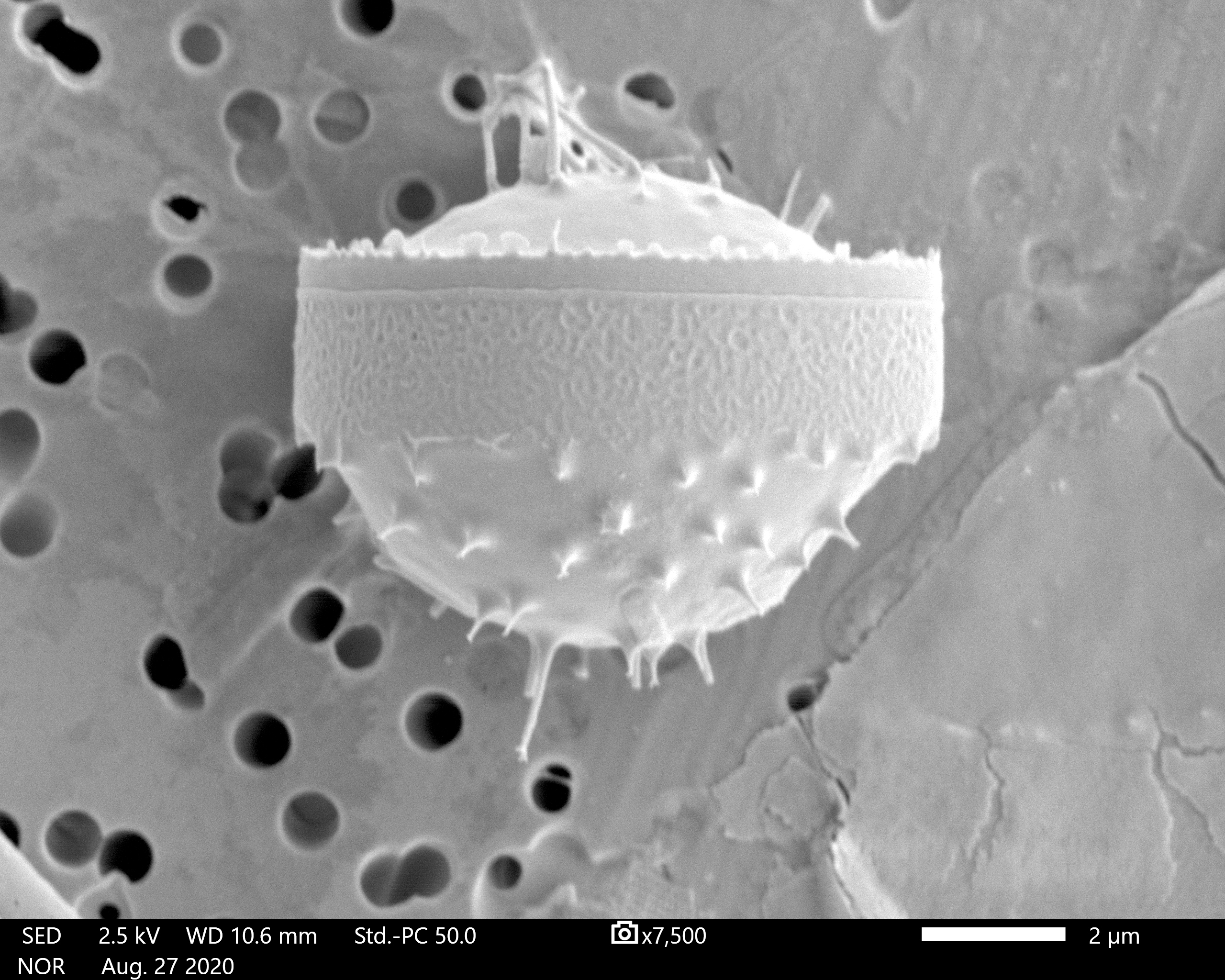 Chaetoceros constrictus SEM5