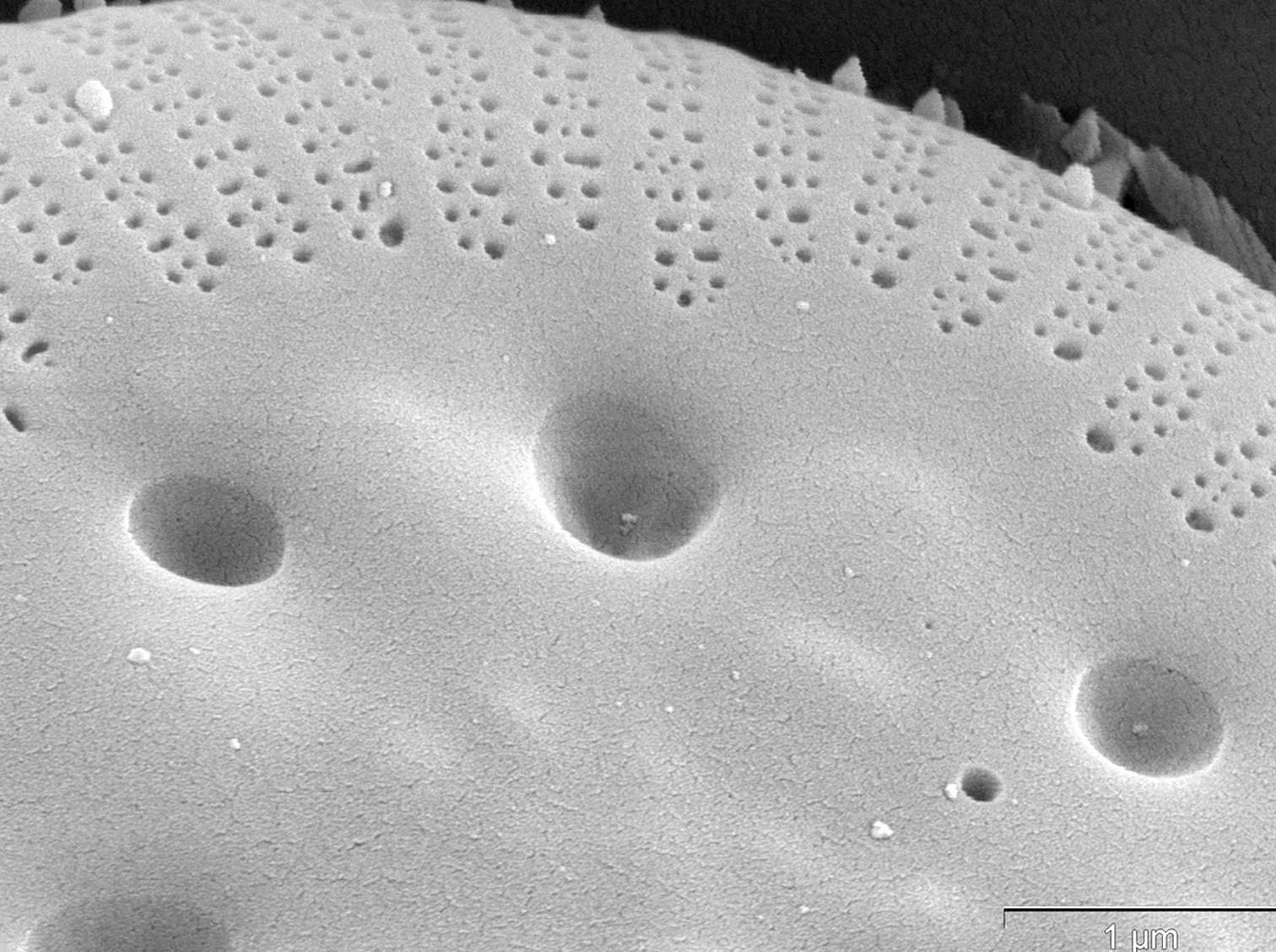 Cyclotella polymorpha SEM2