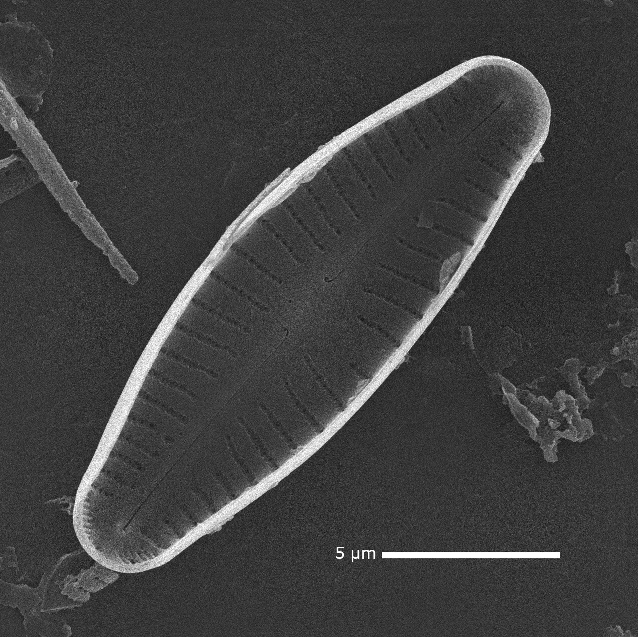 Image Cymbellafalsa-diluviana-SEM-2_MARL105800.jpg | Species - Diatoms ...