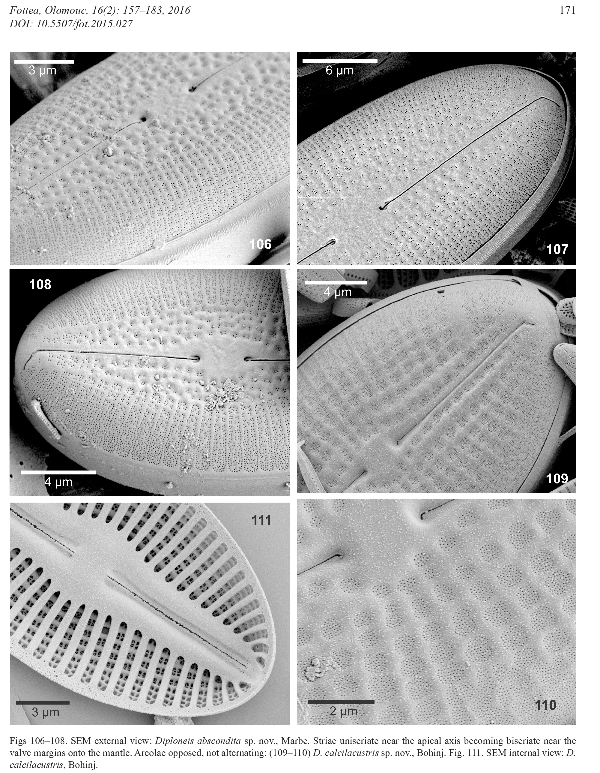 Diploneis Calcilacustris SEM