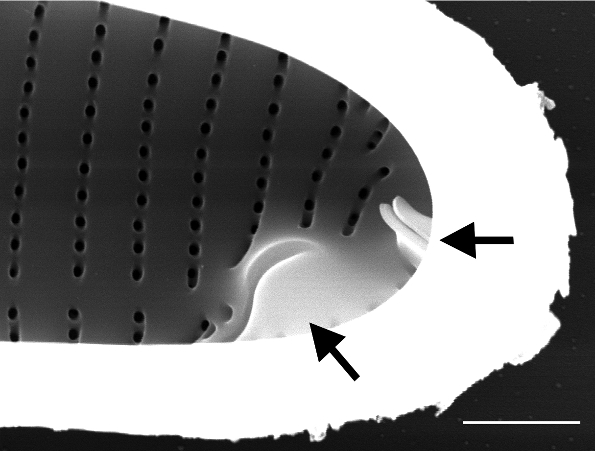 Eunotia areniverma SEM5