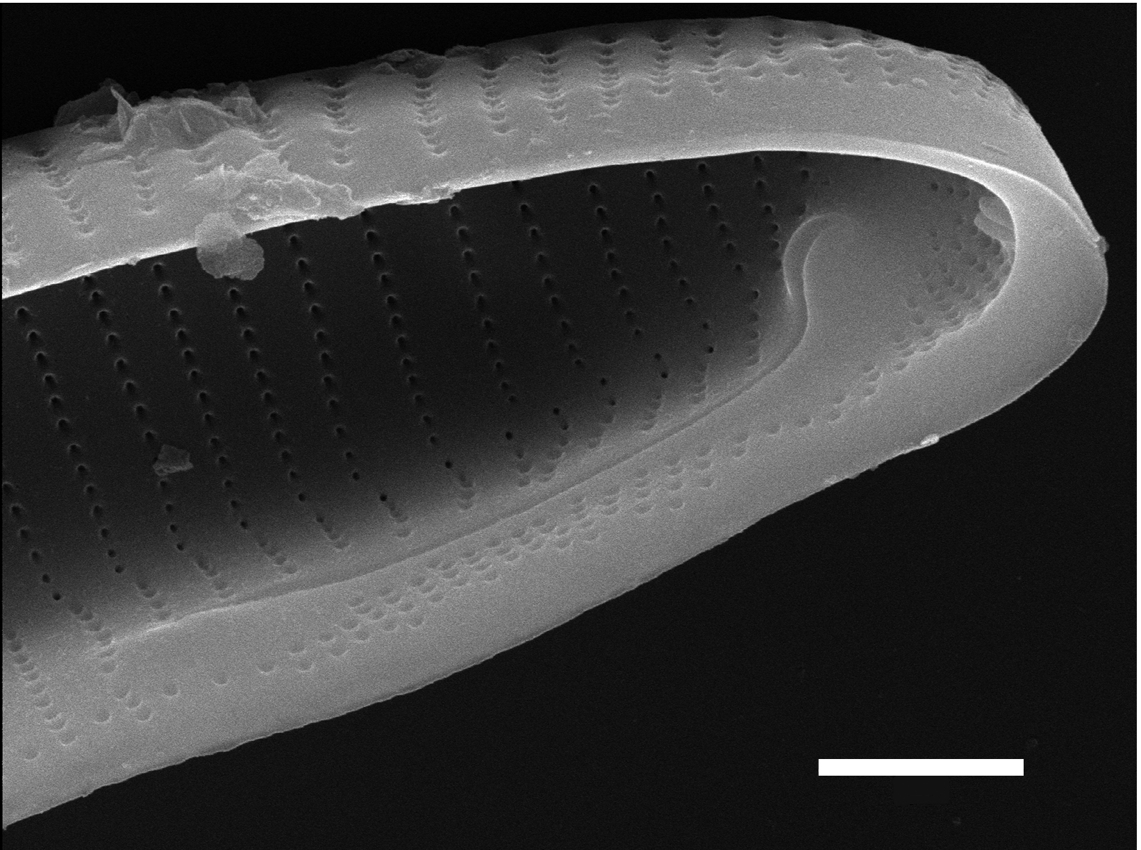 Eunotia macroglossa SEM4