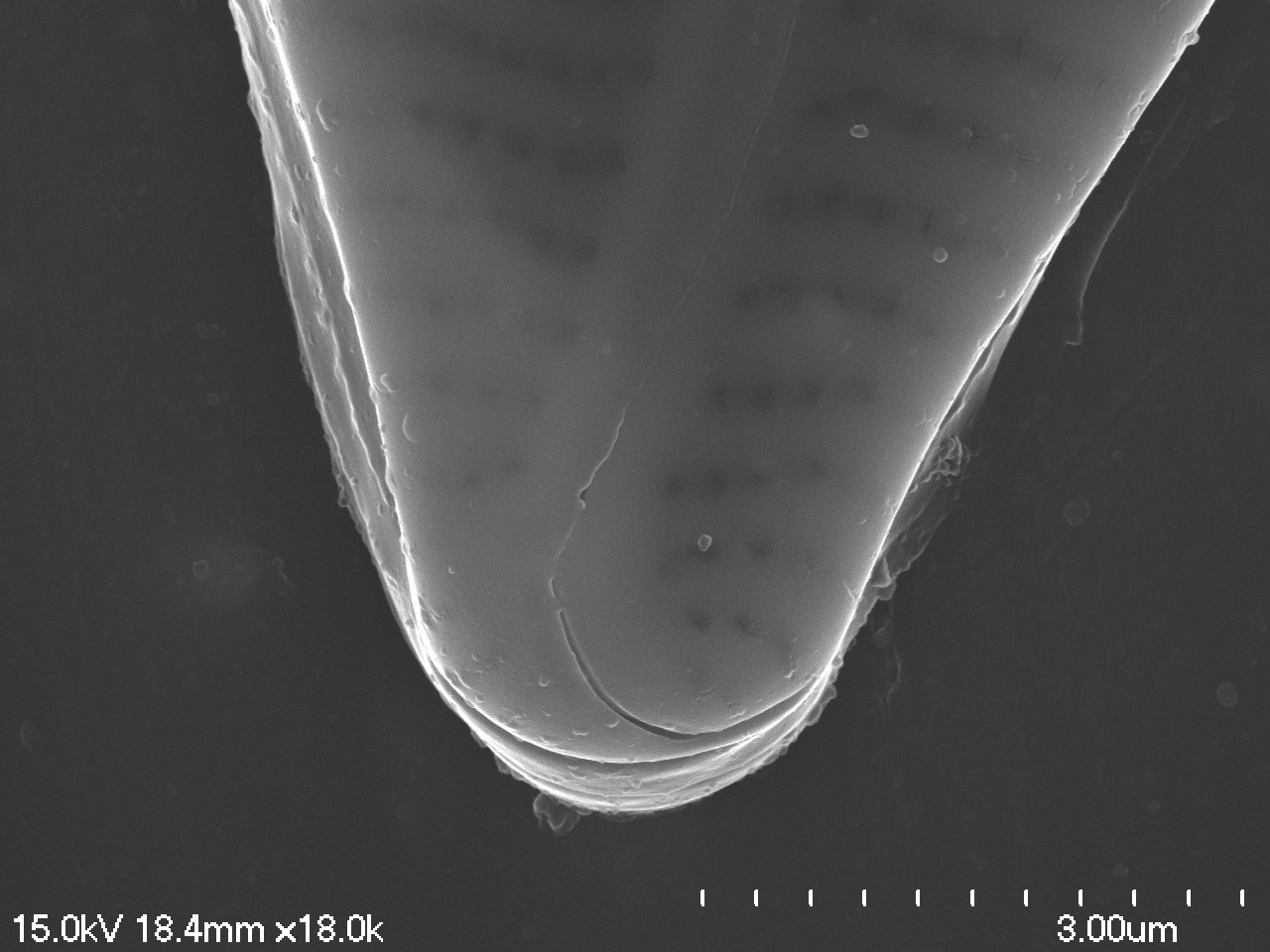 Encyonema hamsherae SEM4