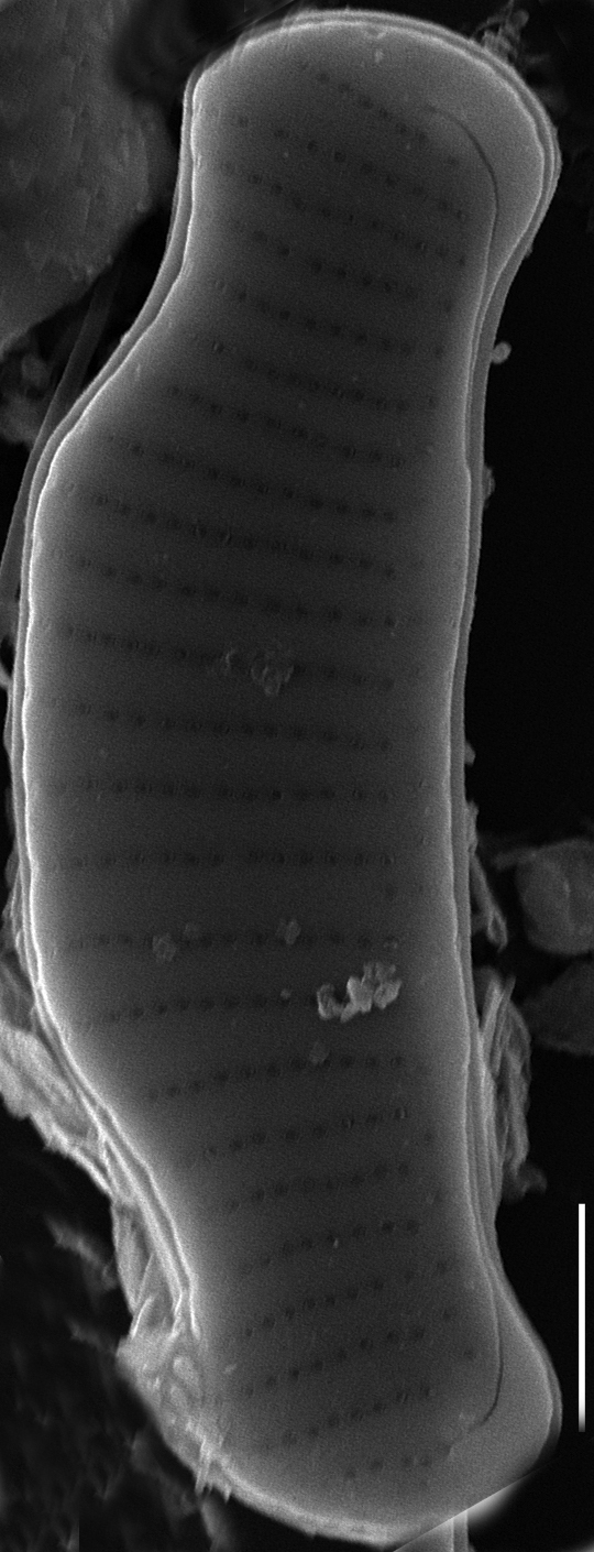 Eunotia cataractarum SEM2