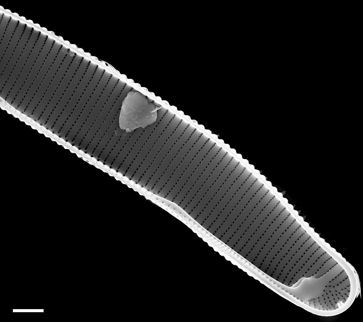 Eunotia lewisii  SEM2