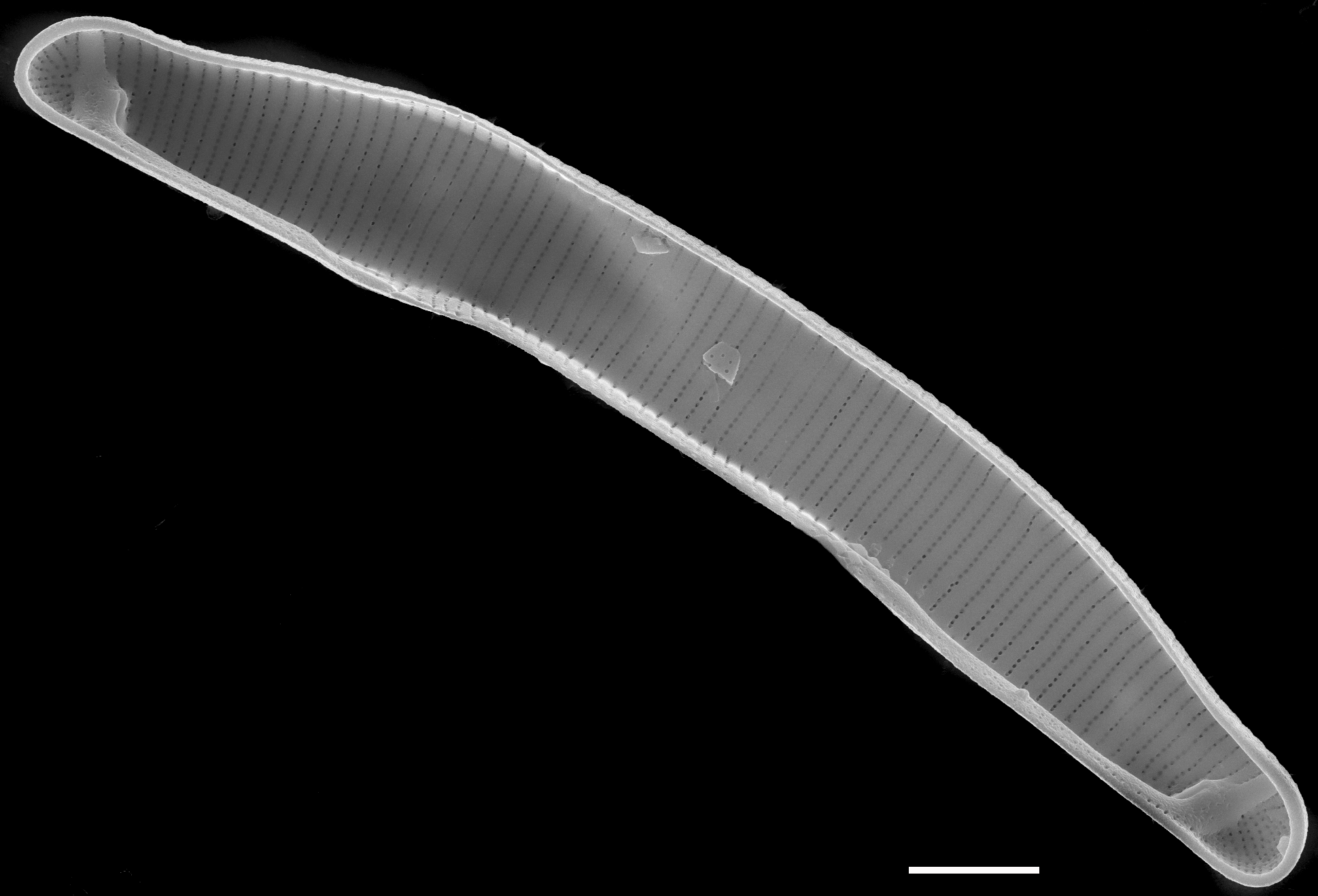 Eunotia lewisii  SEM3