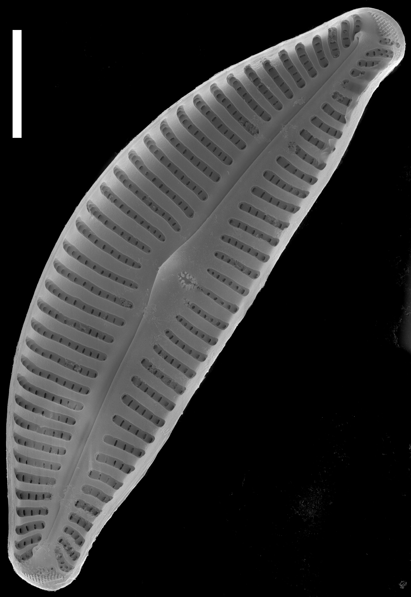 Cymbella affinis SEM1