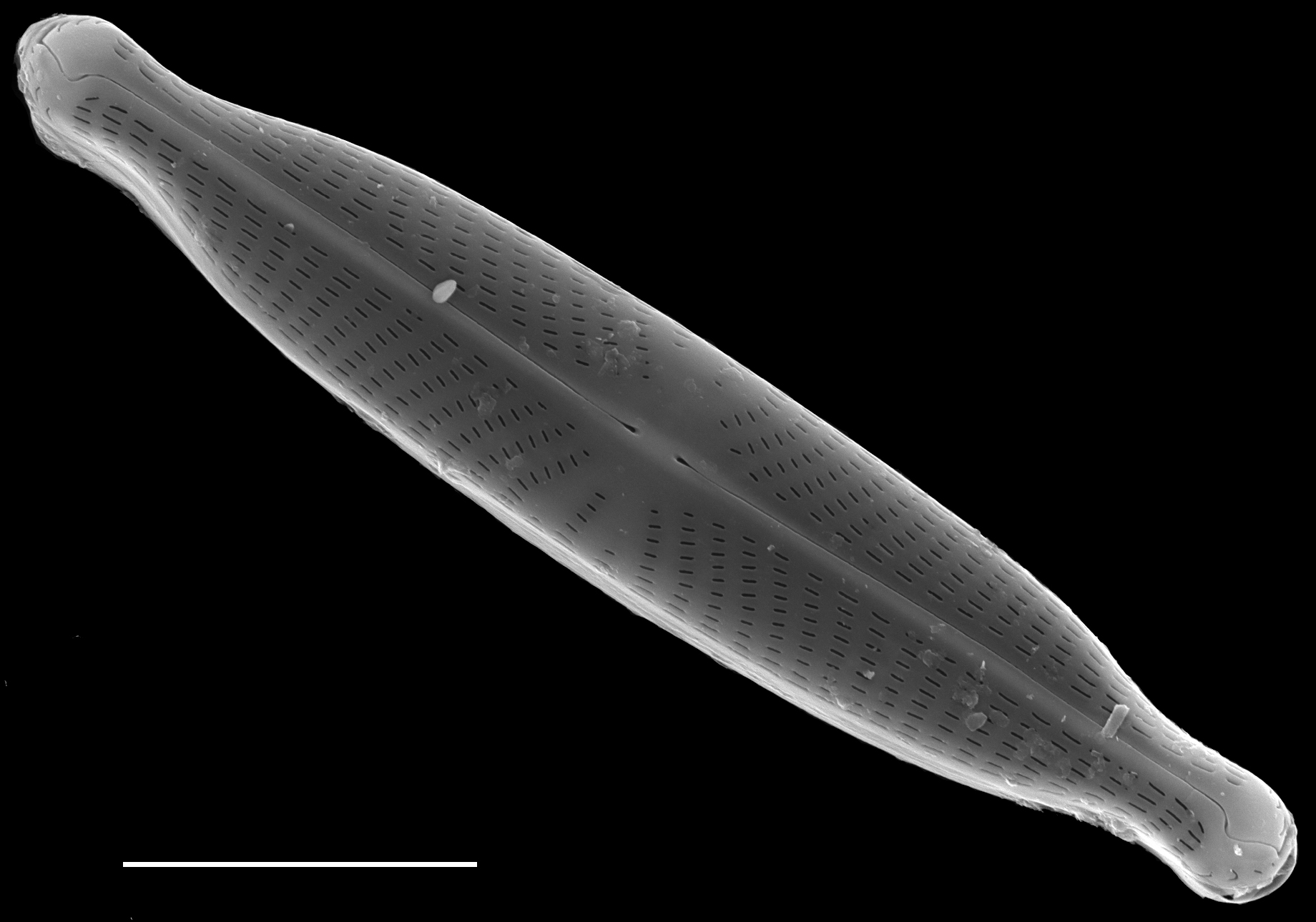 Navicula longicephala SEM1