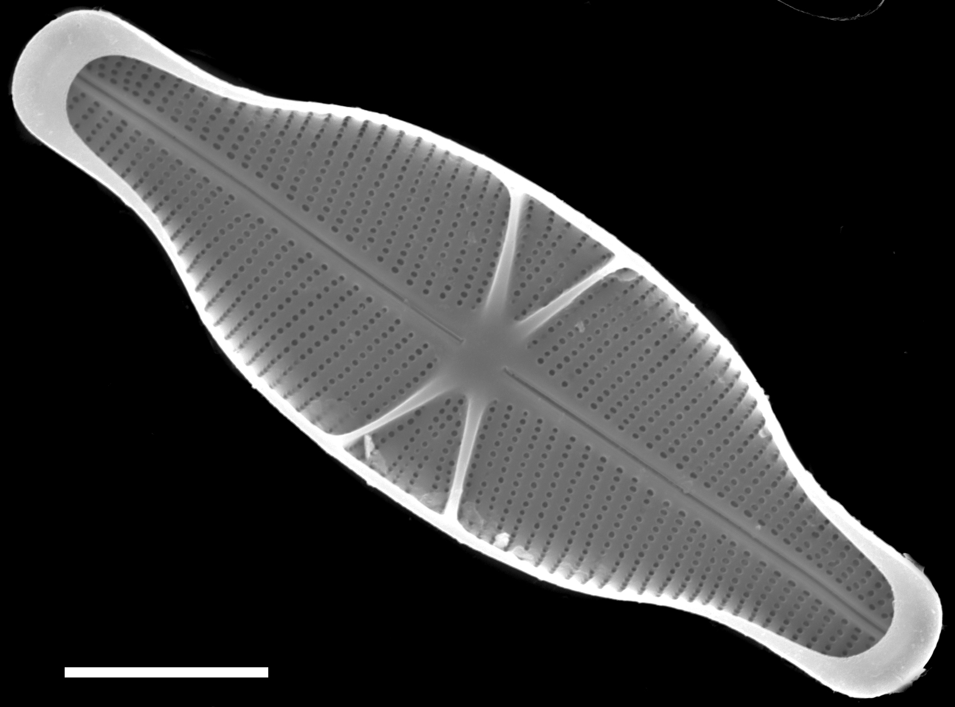 Capartogramma crucicula SEM1