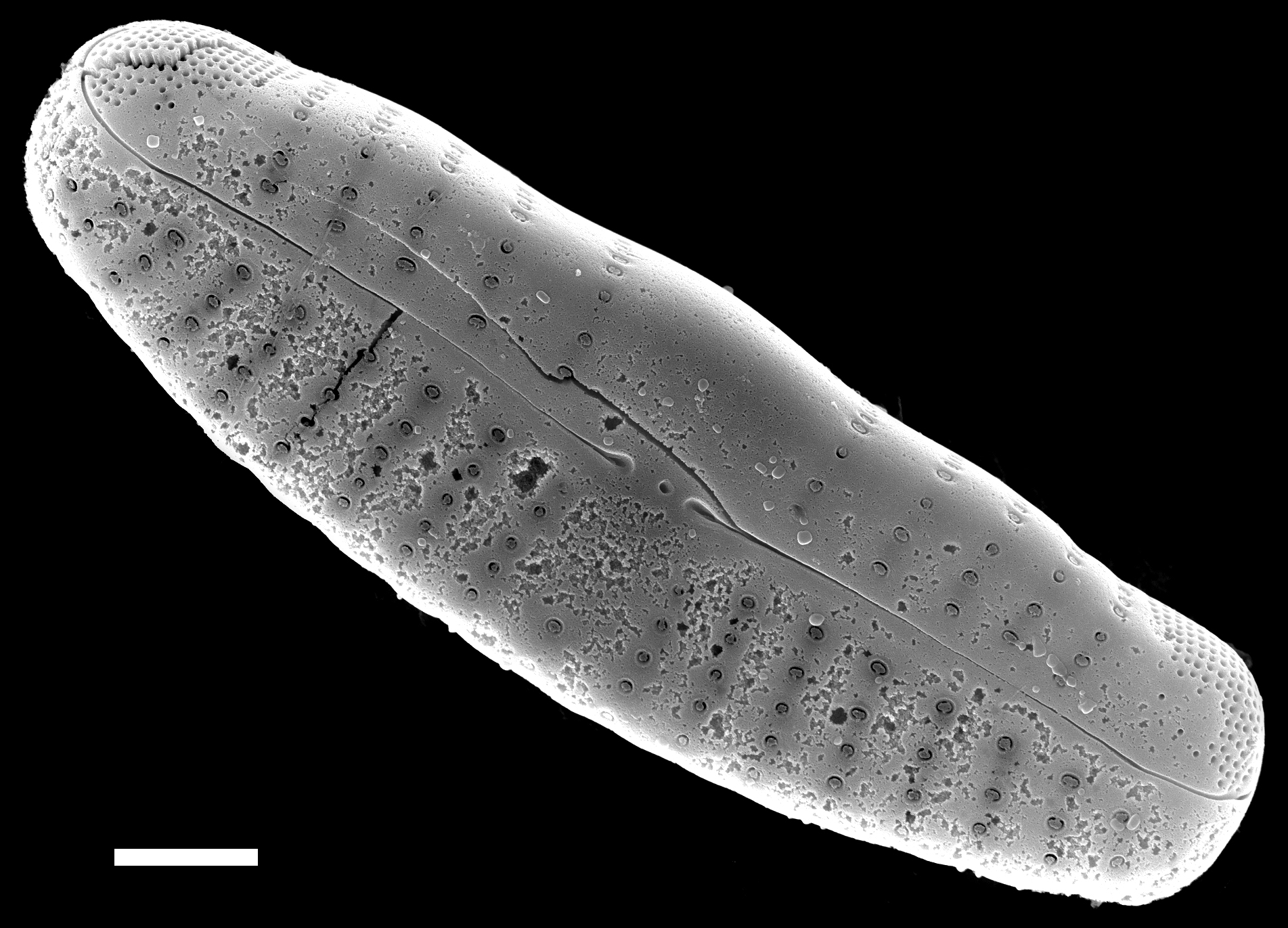 Reimeria uniseriata SEM2