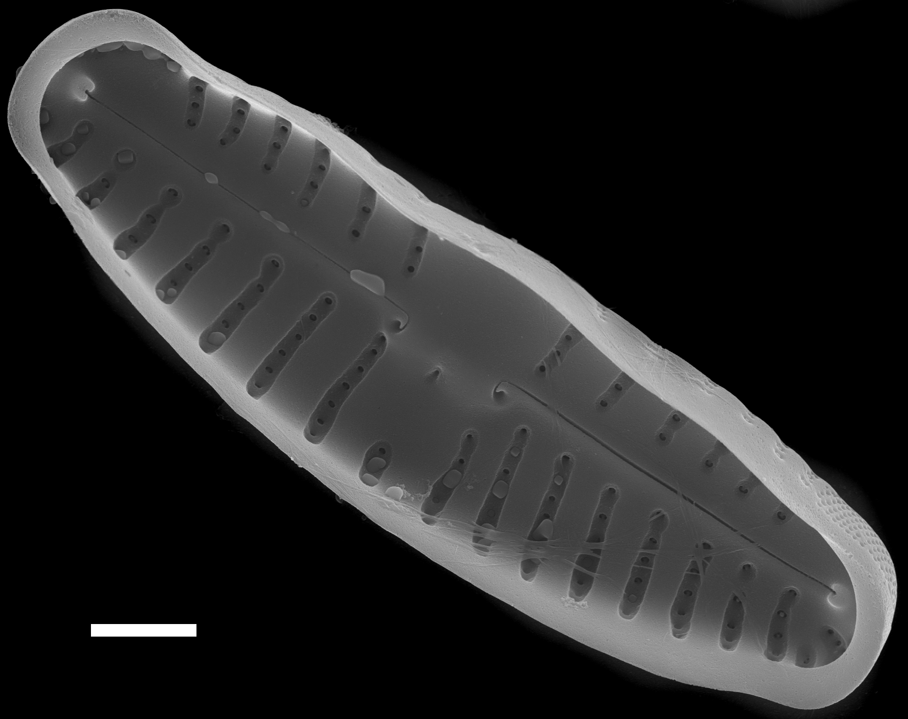 Reimeria uniseriata SEM4