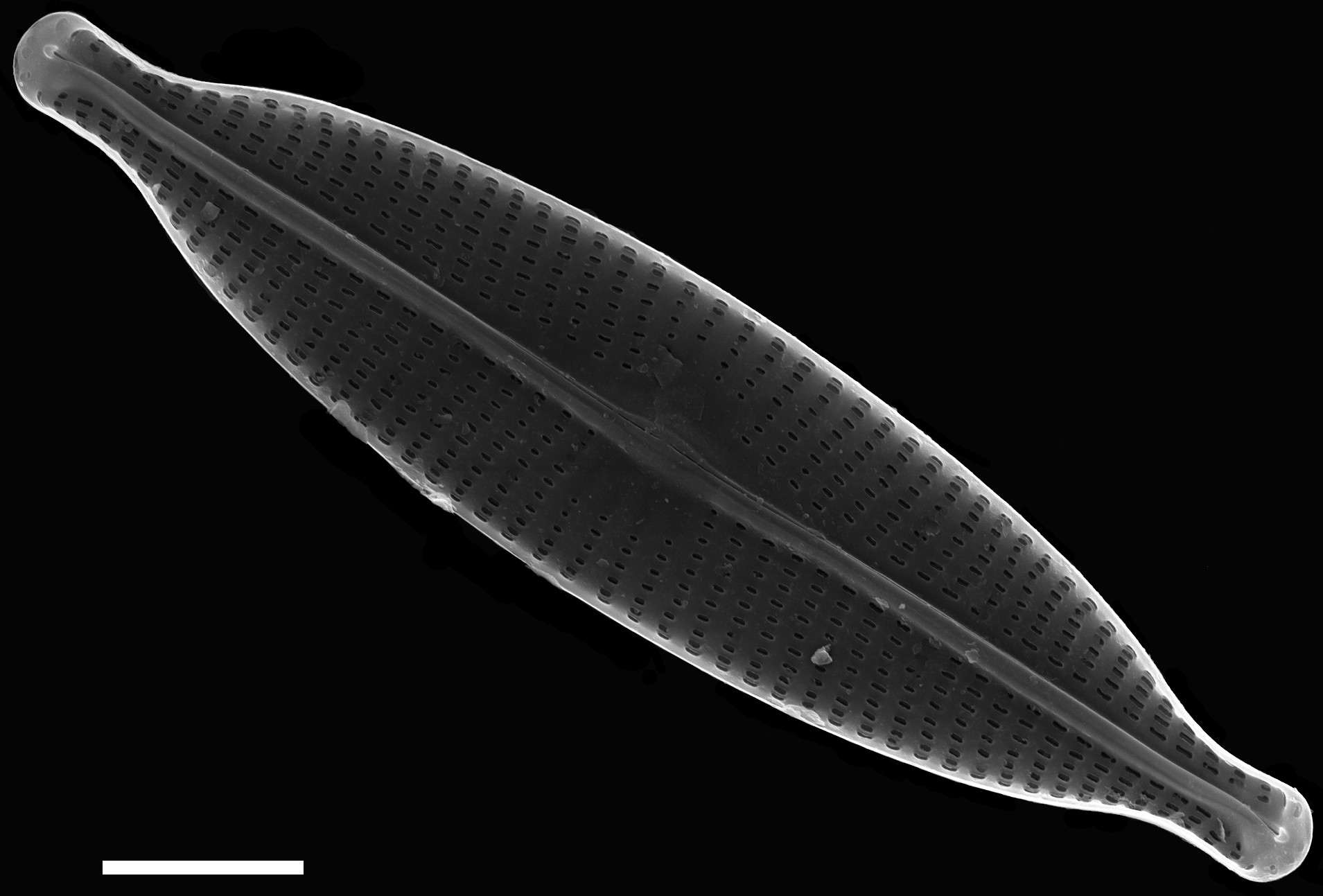 Navicula subrhynchocephala SEM3