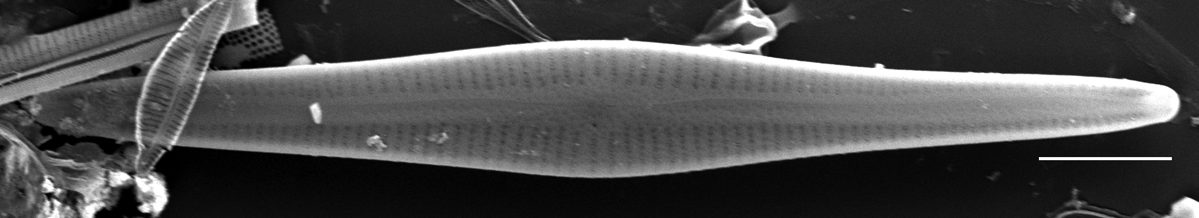 Gomphonema Intricatum Var Vibrio Sem1