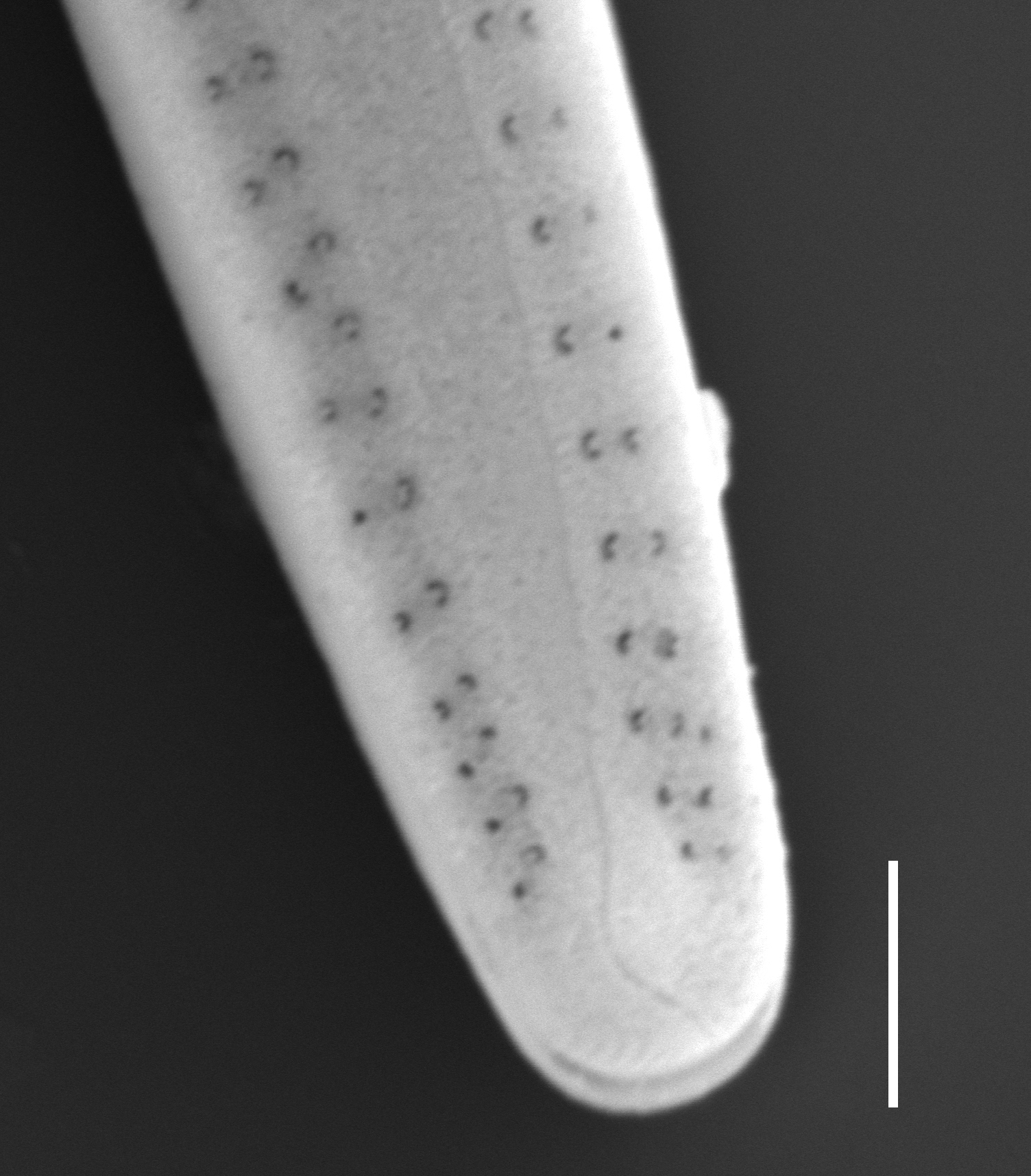 Gomphonema Intricatum Var Vibrio Sem3