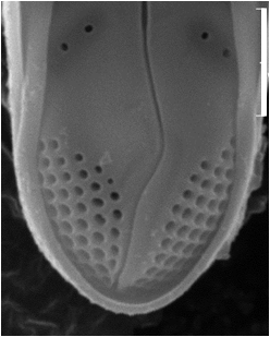 Gomphonema Incognito Img Sem Apical Pore Field