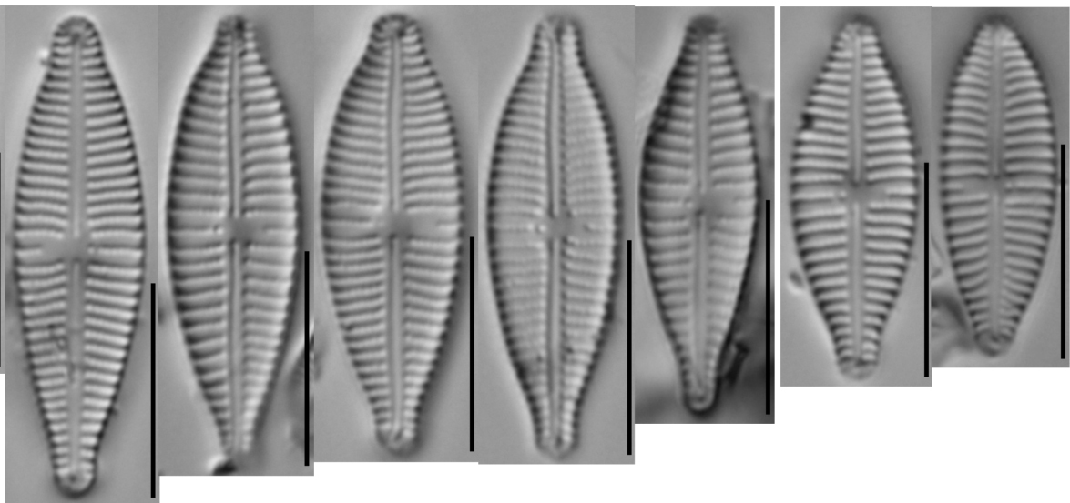 Gomphonema Parvulum Series 3