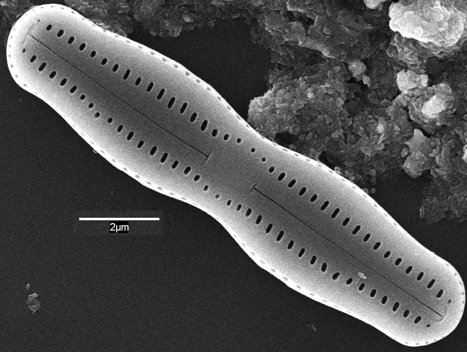 Humidophila undulata SEM3