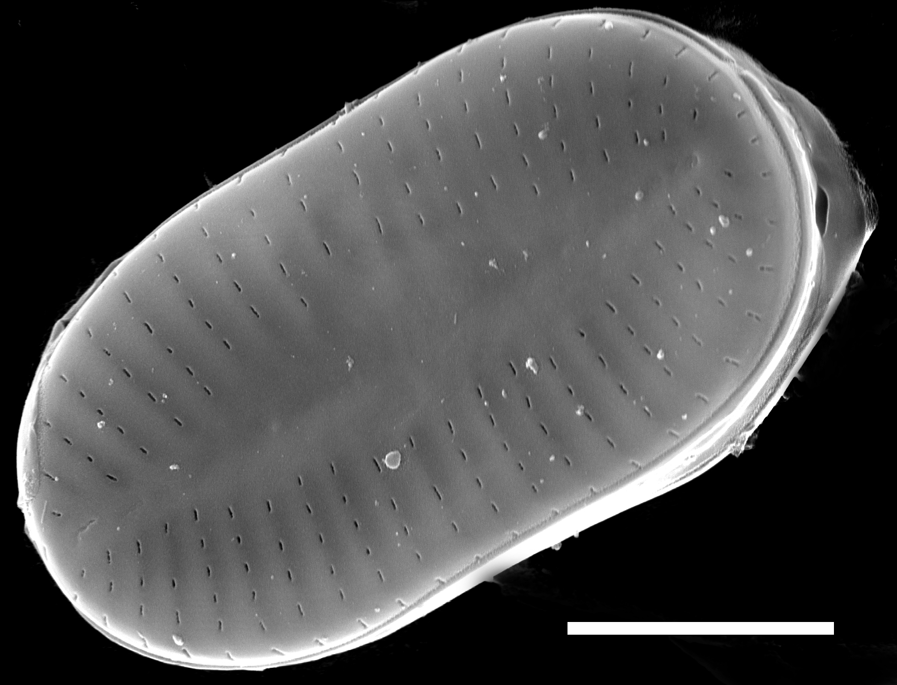 Psammothidium didymum SEM1